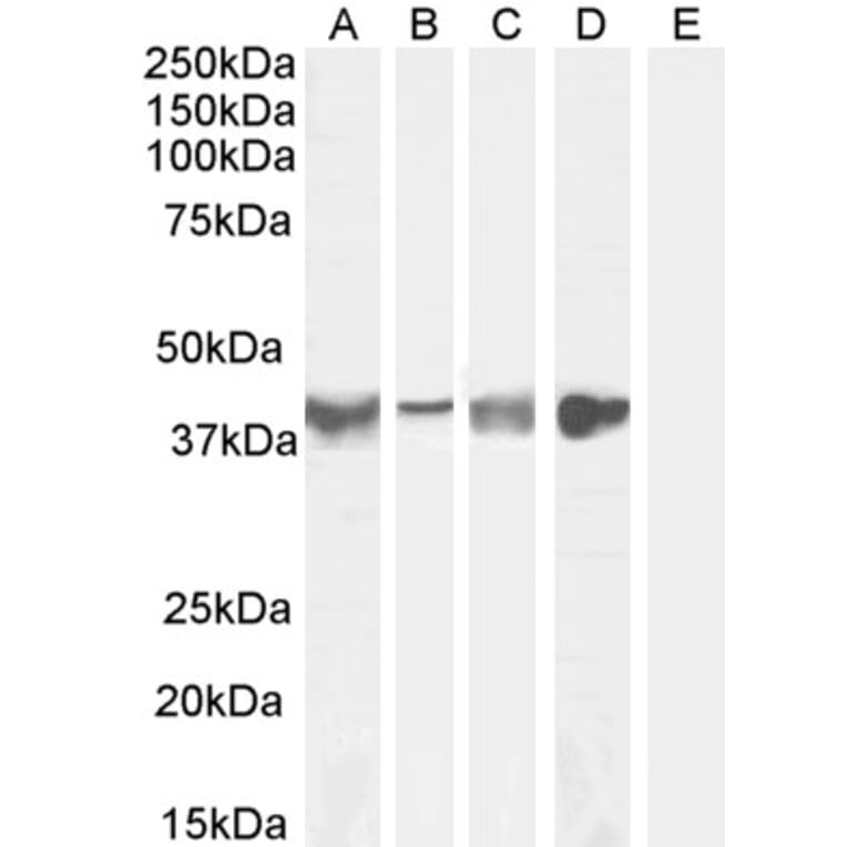 Western Blot - Anti-Asporin Antibody (A84069) - Antibodies.com