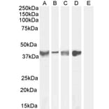 Western Blot - Anti-Asporin Antibody (A84069) - Antibodies.com