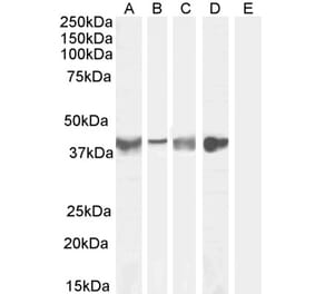 Western Blot - Anti-ASPN Antibody (A84069) - Antibodies.com