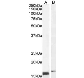 Western Blot - Anti-RBP1 Antibody (A84070) - Antibodies.com