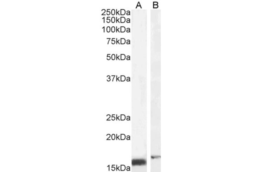 Western Blot - Anti-RBP1 Antibody (A84070) - Antibodies.com