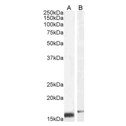 Western Blot - Anti-RBP1 Antibody (A84070) - Antibodies.com