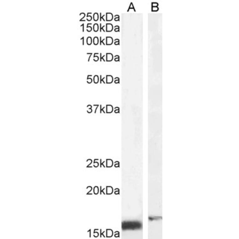 Western Blot - Anti-RBP1 Antibody (A84070) - Antibodies.com