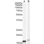Western Blot - Anti-RBP1 Antibody (A84070) - Antibodies.com