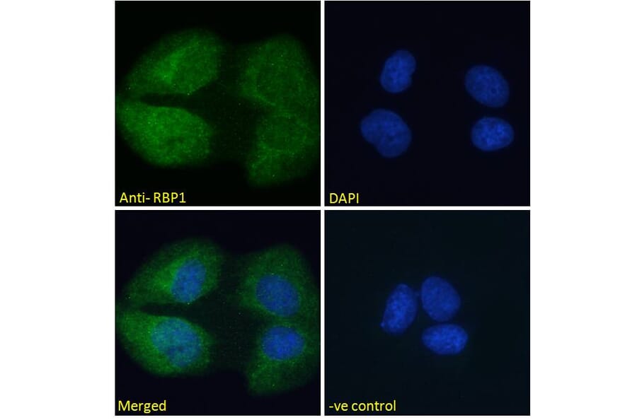 Immunofluorescence - Anti-RBP1 Antibody (A84070) - Antibodies.com
