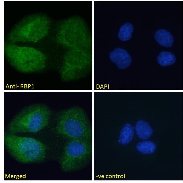 Immunofluorescence - Anti-RBP1 Antibody (A84070) - Antibodies.com