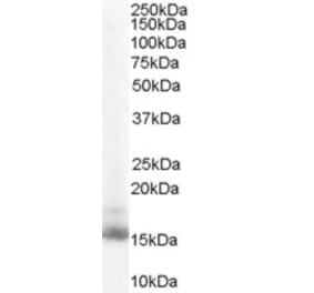 Western Blot - Anti-RBP1 Antibody (A84070) - Antibodies.com