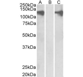 Western Blot - Anti-Pumilio 2 Antibody (A84071) - Antibodies.com