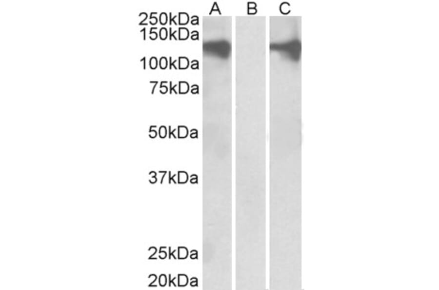 Western Blot - Anti-Pumilio 2 Antibody (A84071) - Antibodies.com