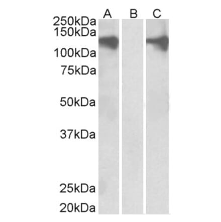 Western Blot - Anti-Pumilio 2 Antibody (A84071) - Antibodies.com