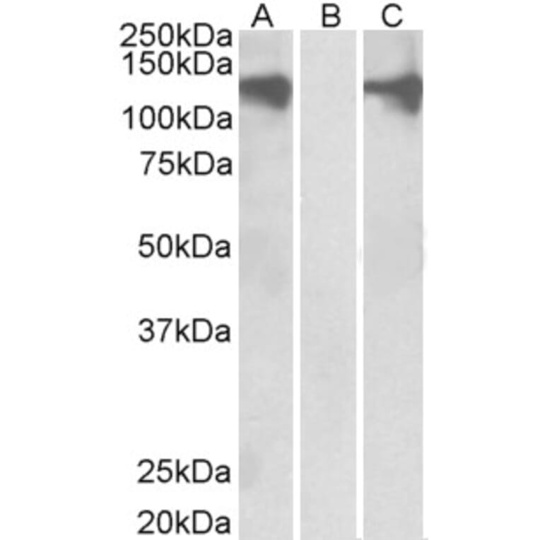 Western Blot - Anti-Pumilio 2 Antibody (A84071) - Antibodies.com