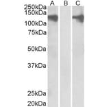 Western Blot - Anti-Pumilio 2 Antibody (A84071) - Antibodies.com