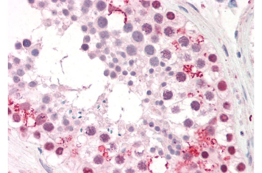 Immunohistochemistry - Anti-Pumilio 2 Antibody (A84071) - Antibodies.com