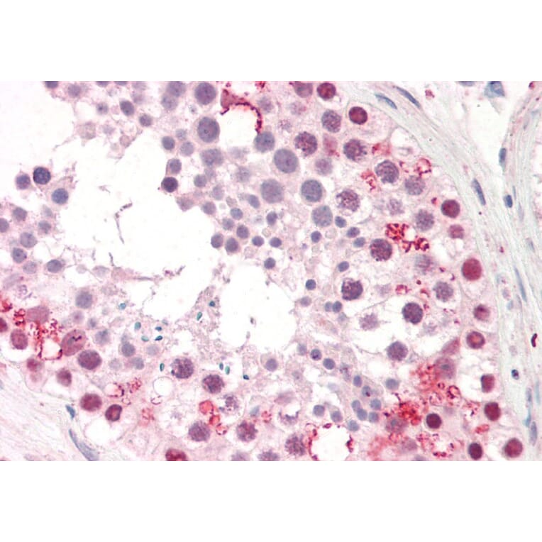 Immunohistochemistry - Anti-Pumilio 2 Antibody (A84071) - Antibodies.com