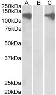 HEK293 lysate (10ug protein in RIPA buffer) overexpressing Human PUM2 with DYKDDDDK tag probed with Anti-PUM2 Antibody (A84071) (0.5µg/ml) in Lane A and probed with anti- DYKDDDDK Tag (1/3000) in lane C. Mock-transfected HEK293 probed with Anti-PUM2 Antibody (A84071) (1mg/ml) in Lane B. Primary incubations were for 1 hour. Detected by chemiluminescence.