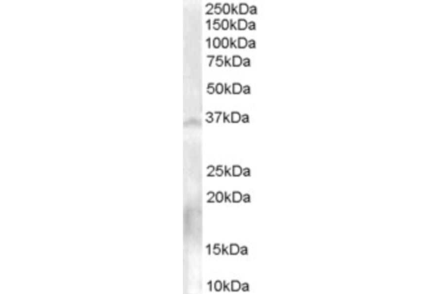 Western Blot - Anti-NOS-1 Antibody (A84072) - Antibodies.com