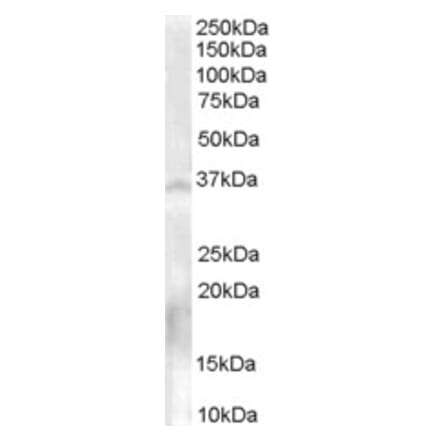 Western Blot - Anti-NOS-1 Antibody (A84072) - Antibodies.com