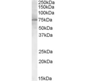 Western Blot - Anti-PCSK9 Antibody (A84073) - Antibodies.com