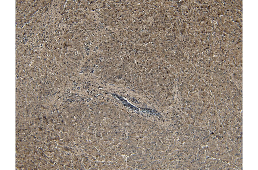 Immunohistochemistry - Anti-PCSK9 Antibody (A84073) - Antibodies.com