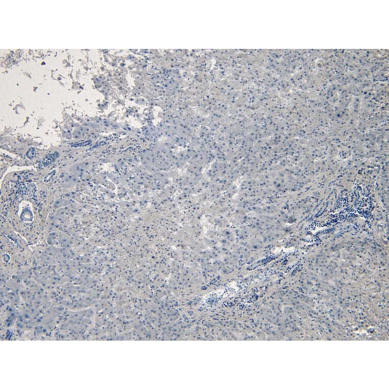 Immunohistochemistry - Anti-PCSK9 Antibody (A84073) - Antibodies.com