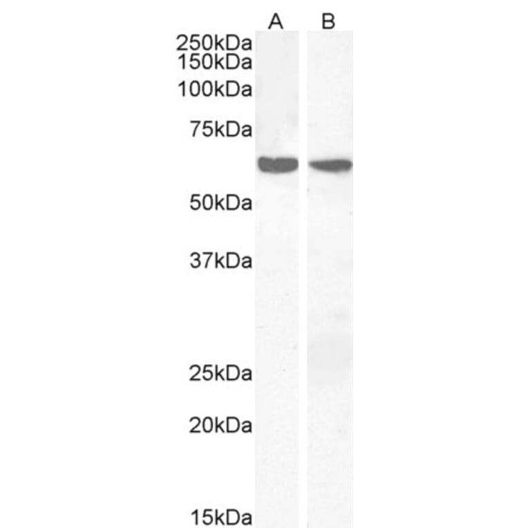 Western Blot - Anti-PPP2R1A Antibody (A84078) - Antibodies.com