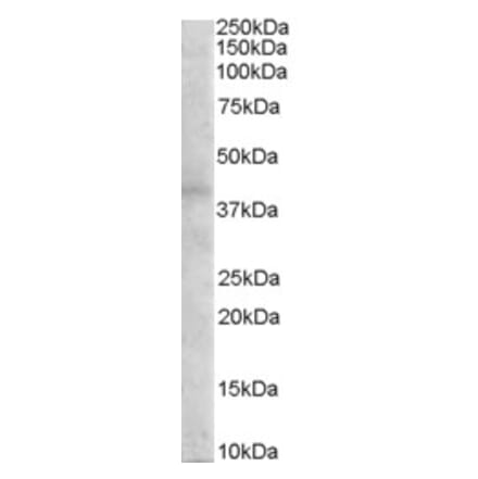 Western Blot - Anti-MC3-R Antibody (A84081) - Antibodies.com