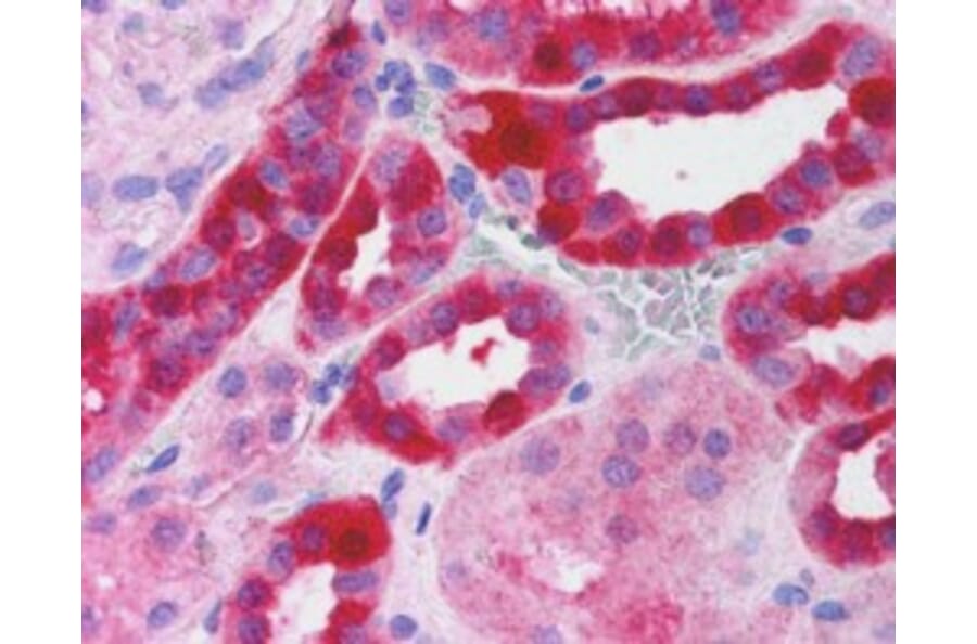 Immunohistochemistry - Anti-RICTOR Antibody (A84082) - Antibodies.com