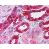 Immunohistochemistry - Anti-RICTOR Antibody (A84082) - Antibodies.com