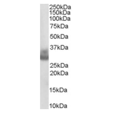 Western Blot - Anti-Cathepsin F Antibody (A84083) - Antibodies.com