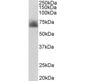 Western Blot - Anti-Serotonin Transporter Antibody (A84084) - Antibodies.com