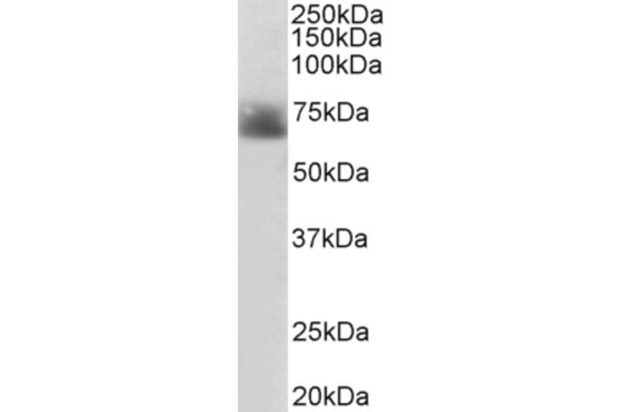 Western Blot - Anti-Serotonin Transporter Antibody (A84084) - Antibodies.com