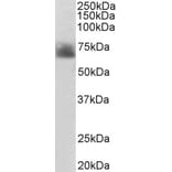 Western Blot - Anti-Serotonin Transporter Antibody (A84084) - Antibodies.com