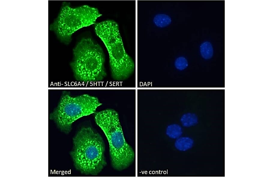 Immunofluorescence - Anti-Serotonin Transporter Antibody (A84084) - Antibodies.com