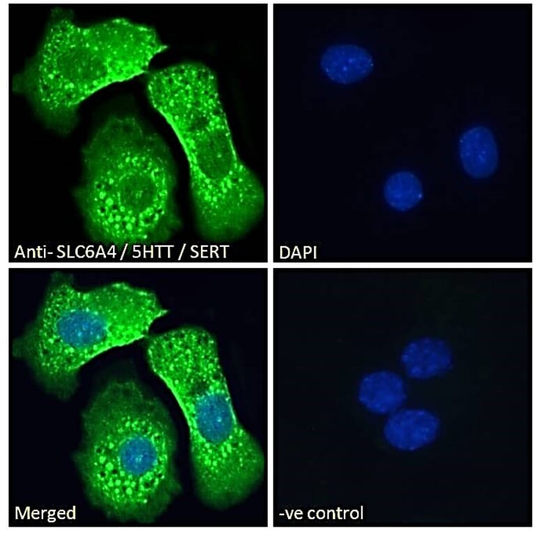 Immunofluorescence - Anti-Serotonin Transporter Antibody (A84084) - Antibodies.com
