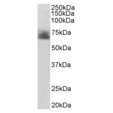 Western Blot - Anti-Serotonin transporter Antibody (A84084)