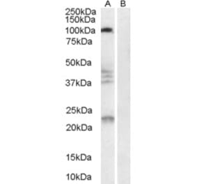 Western Blot - Anti-Nogo Receptor Antibody (A84086) - Antibodies.com