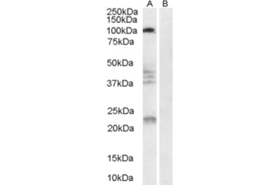 Western Blot - Anti-Nogo Receptor Antibody (A84086) - Antibodies.com