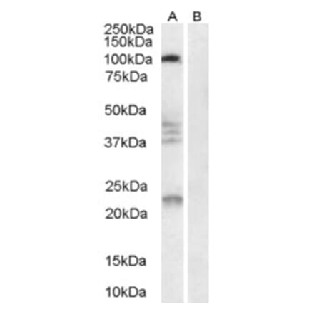 Western Blot - Anti-Nogo Receptor Antibody (A84086) - Antibodies.com