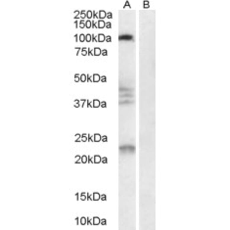 Western Blot - Anti-Nogo Receptor Antibody (A84086) - Antibodies.com