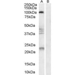 Western Blot - Anti-Nogo Receptor Antibody (A84086) - Antibodies.com