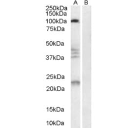 Western Blot - Anti-RTN4R Antibody (A84086) - Antibodies.com