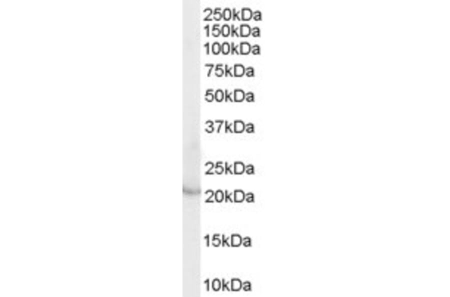 Western Blot - Anti-Lipocalin-2/NGAL Antibody (A84088) - Antibodies.com