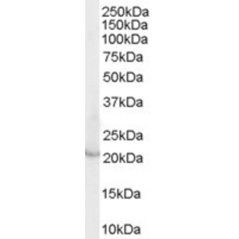 Western Blot - Anti-Lipocalin-2/NGAL Antibody (A84088) - Antibodies.com