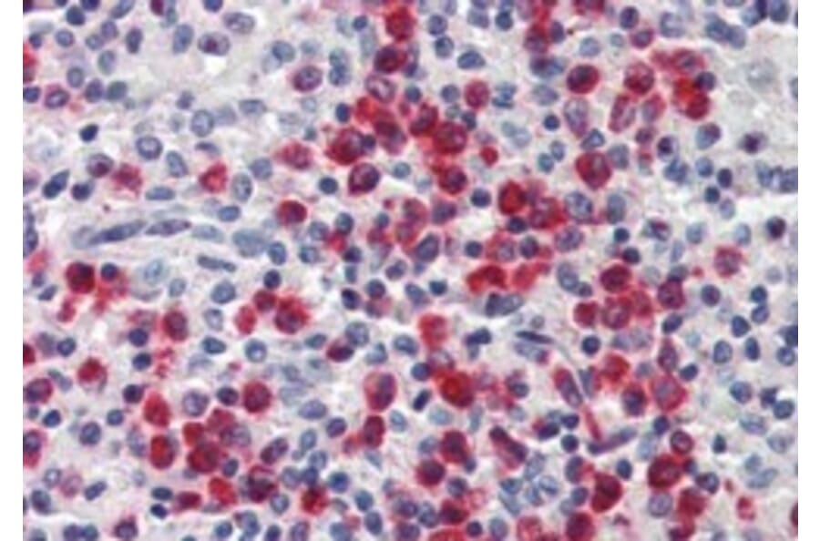 Immunohistochemistry - Anti-Lipocalin-2/NGAL Antibody (A84088) - Antibodies.com