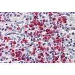 Immunohistochemistry - Anti-Lipocalin-2/NGAL Antibody (A84088) - Antibodies.com
