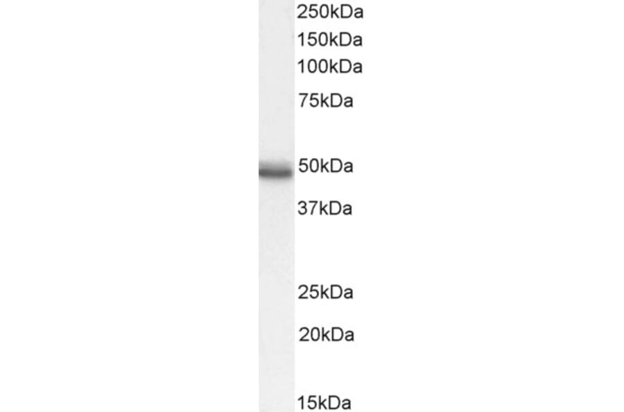 Western Blot - Anti-CCKBR Antibody (A84091) - Antibodies.com