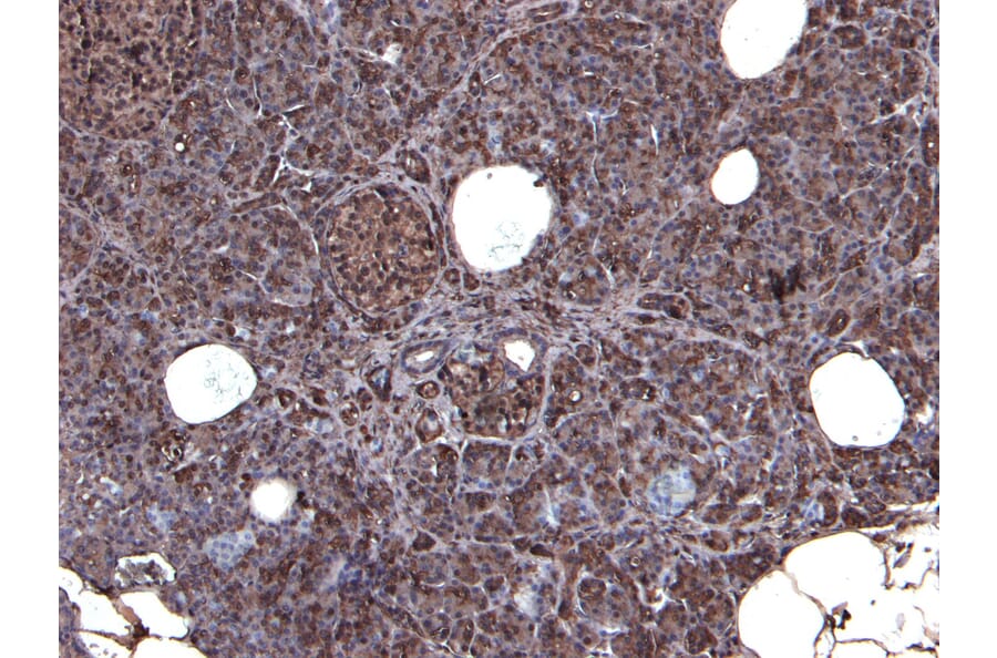 Immunohistochemistry - Anti-CCKBR Antibody (A84091) - Antibodies.com