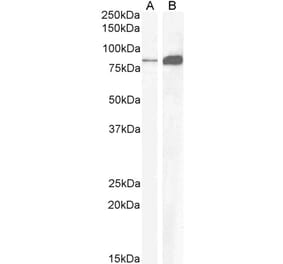 Western Blot - Anti-CCKBR Antibody (A84091) - Antibodies.com