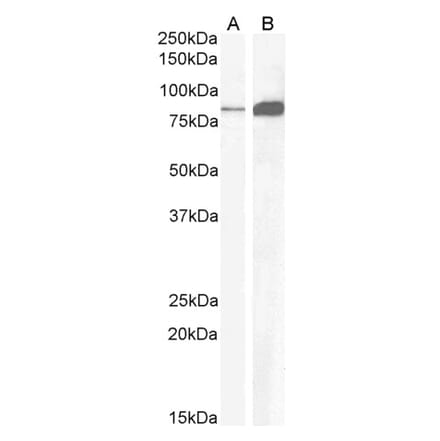 Western Blot - Anti-CCKBR Antibody (A84091) - Antibodies.com