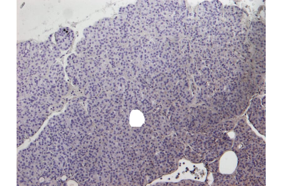 Immunohistochemistry - Anti-CCKBR Antibody (A84091) - Antibodies.com